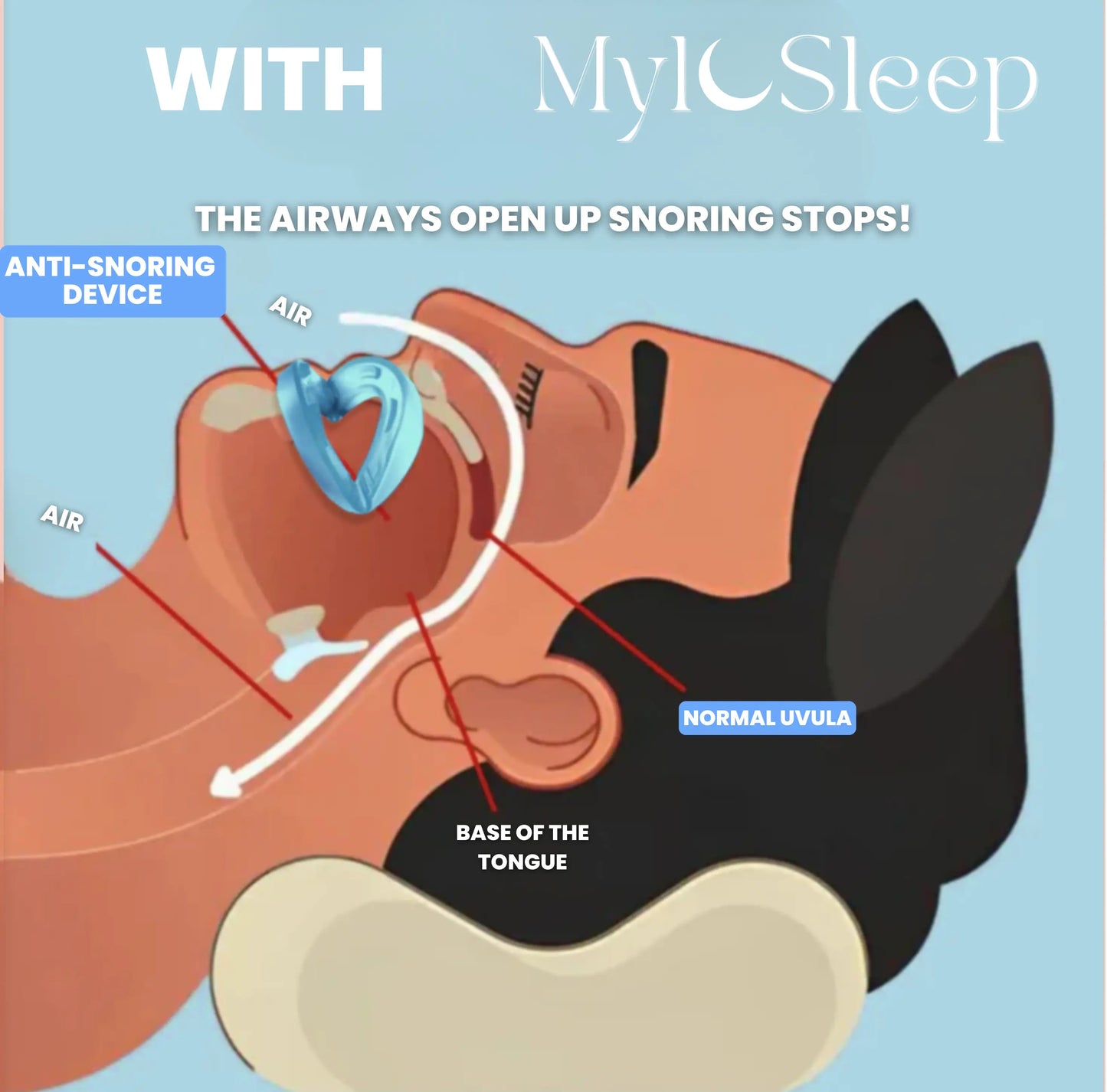 Anti-Snoring Sleep Comfort Device